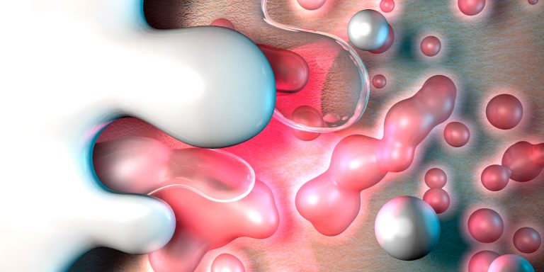 topical-corticosteroids-main